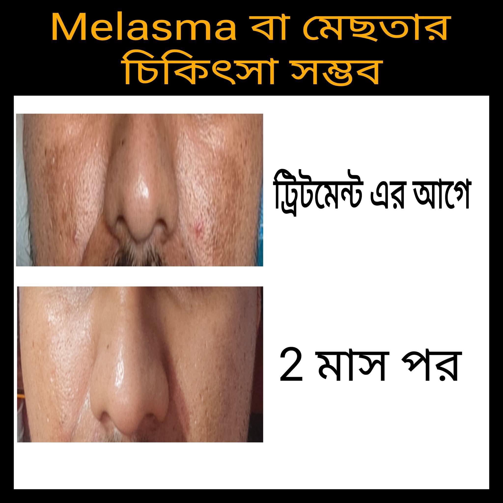 Treatment Image 1