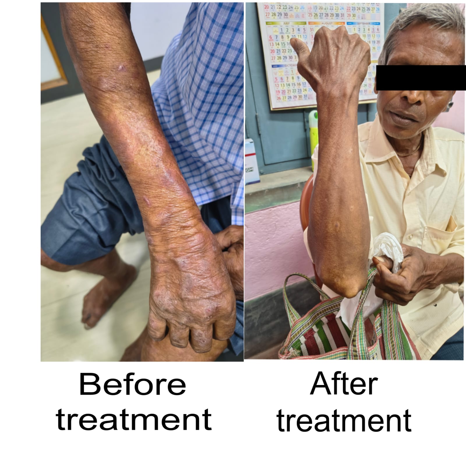 Treatment Image 11