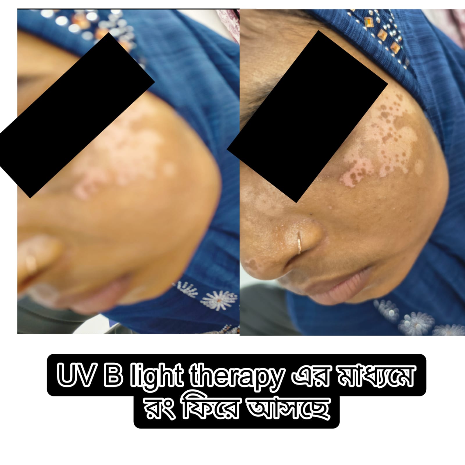Treatment Image 13