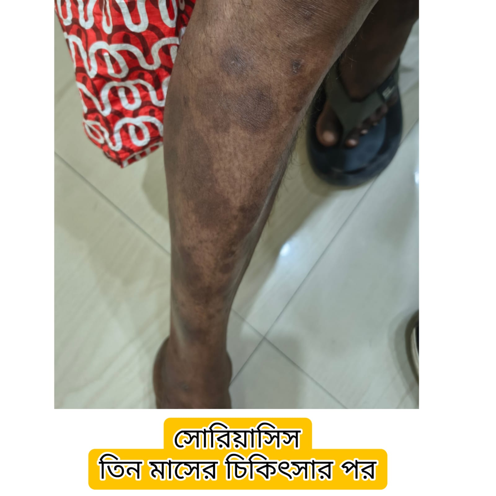 Treatment Image 15