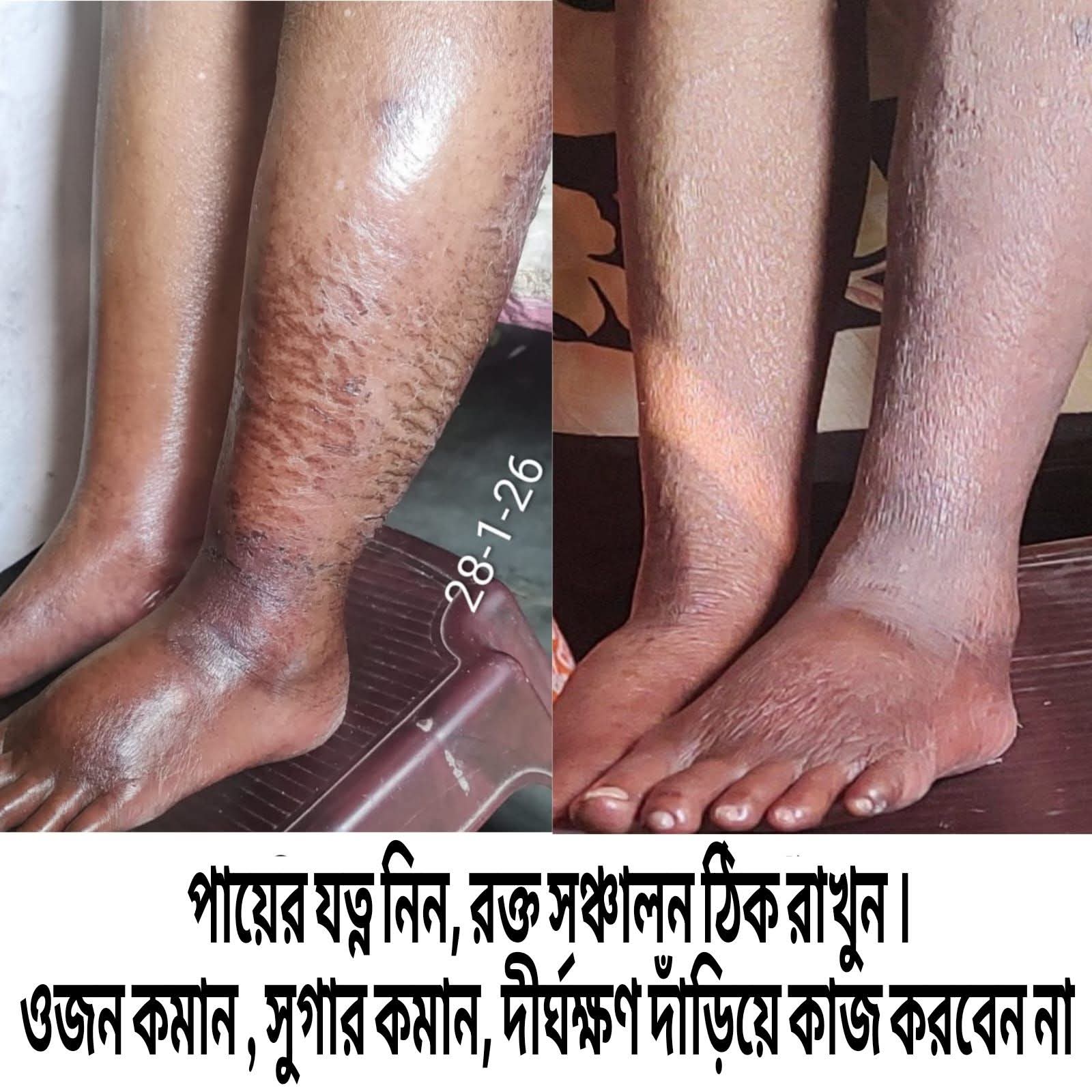 Treatment Image 18