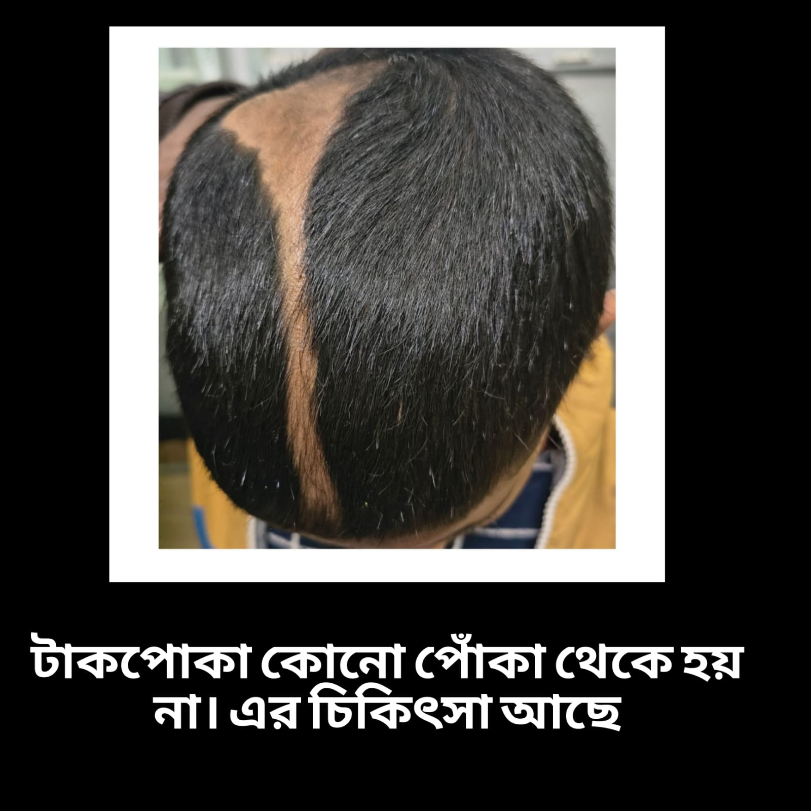 Takpoka best treatment berhampore. 
                                                                           Chul pora best treatment berhampore.
                                                                           Chul pora best doctor berhampore. 
                                                                           Alopecia treatment doctor berhampore.