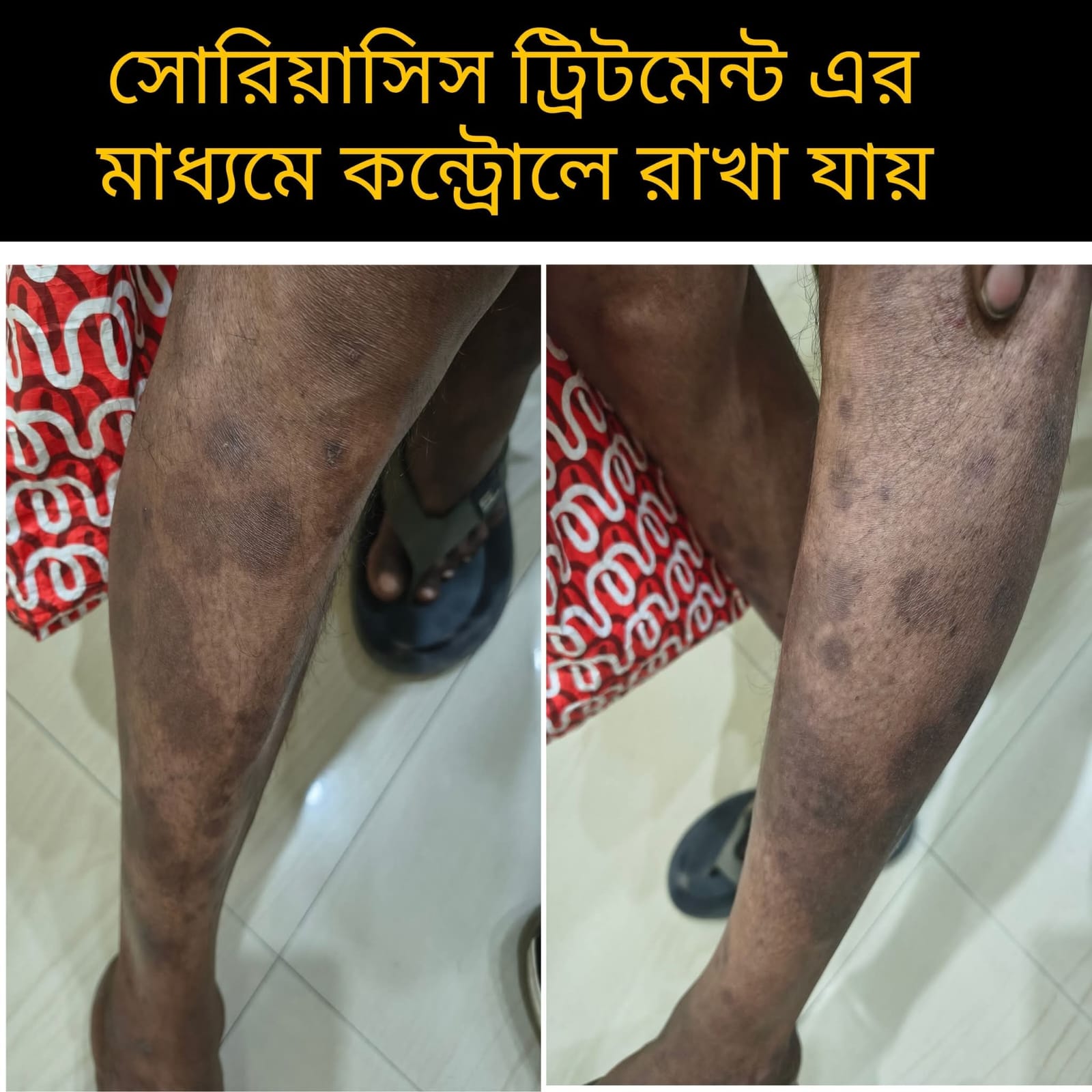 Treatment Image 3