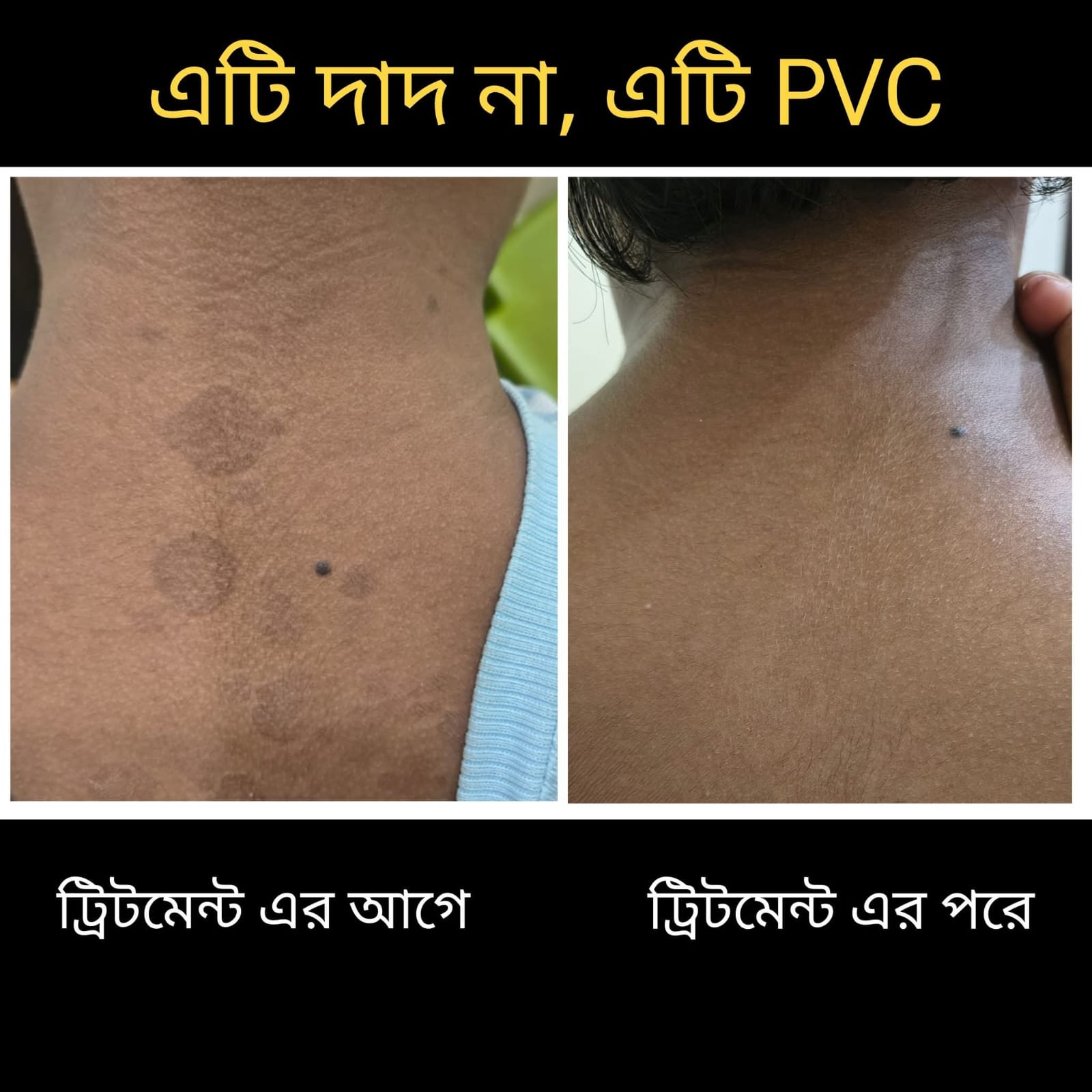 Treatment Image 5