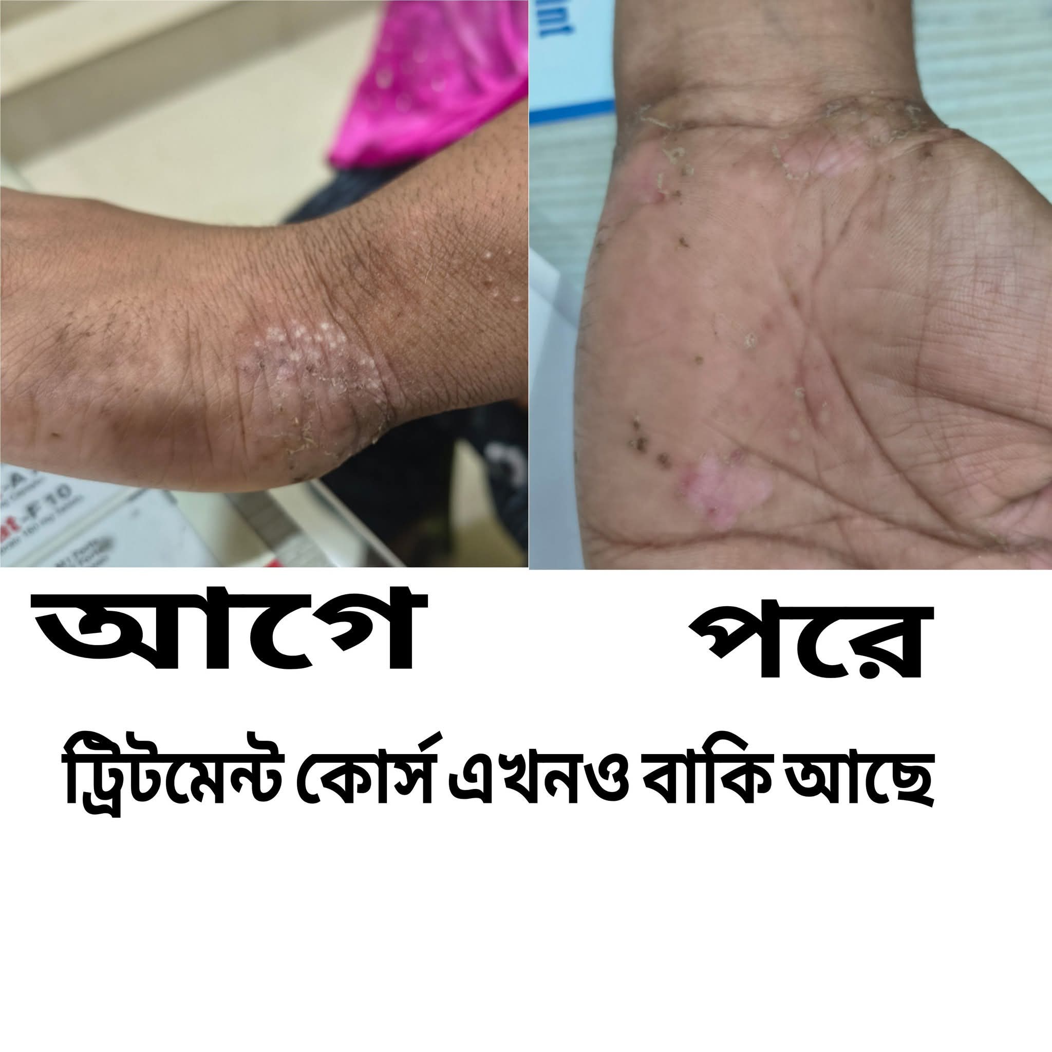 Treatment Image 6