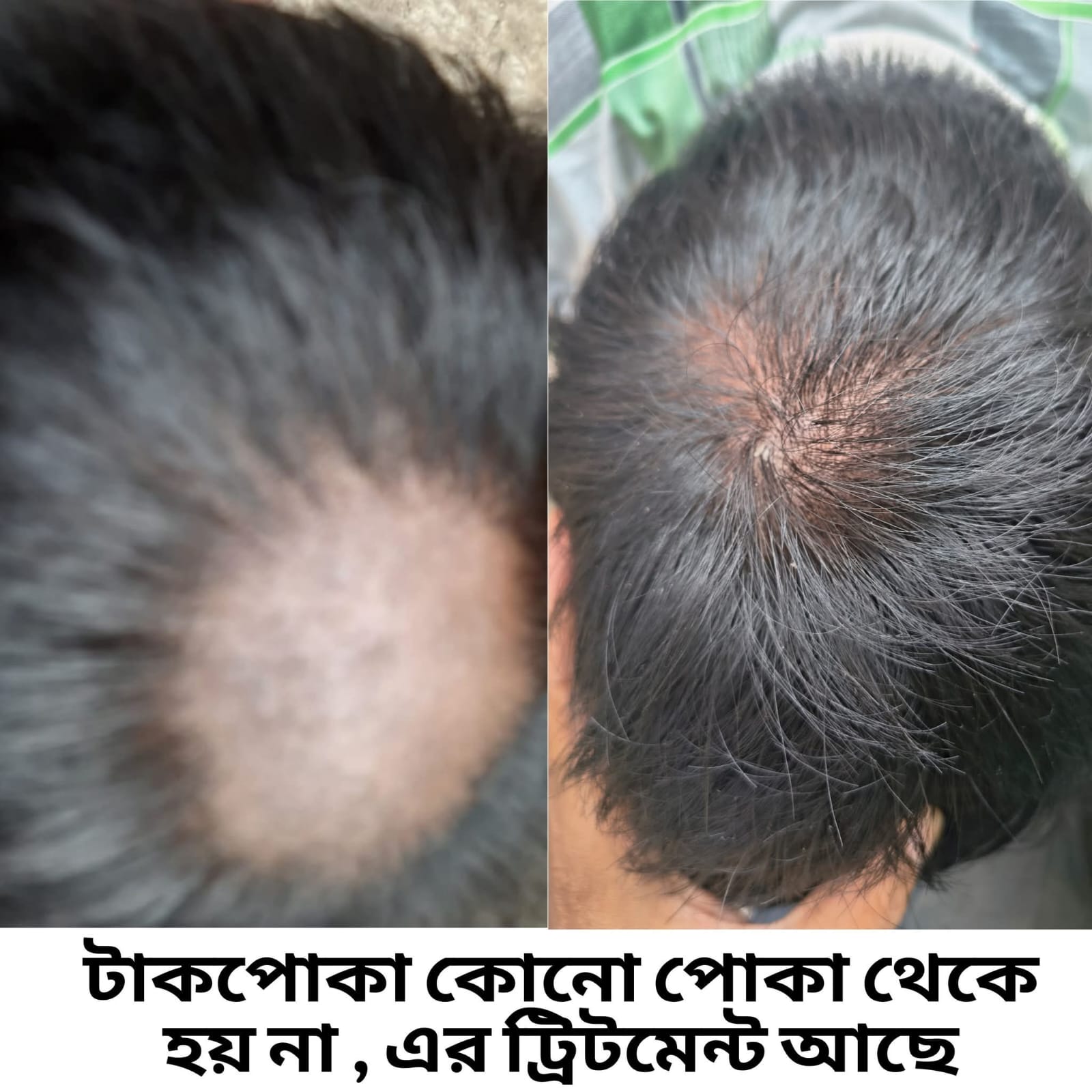 Treatment Image 7