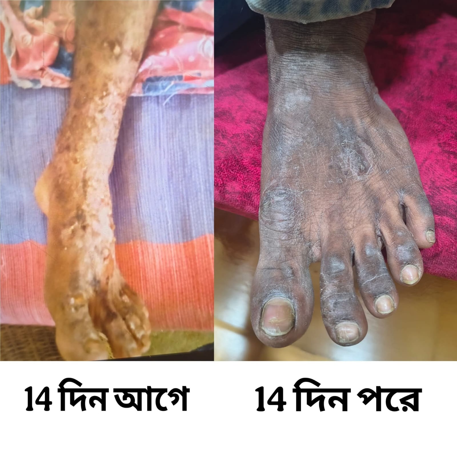 Treatment Image 8