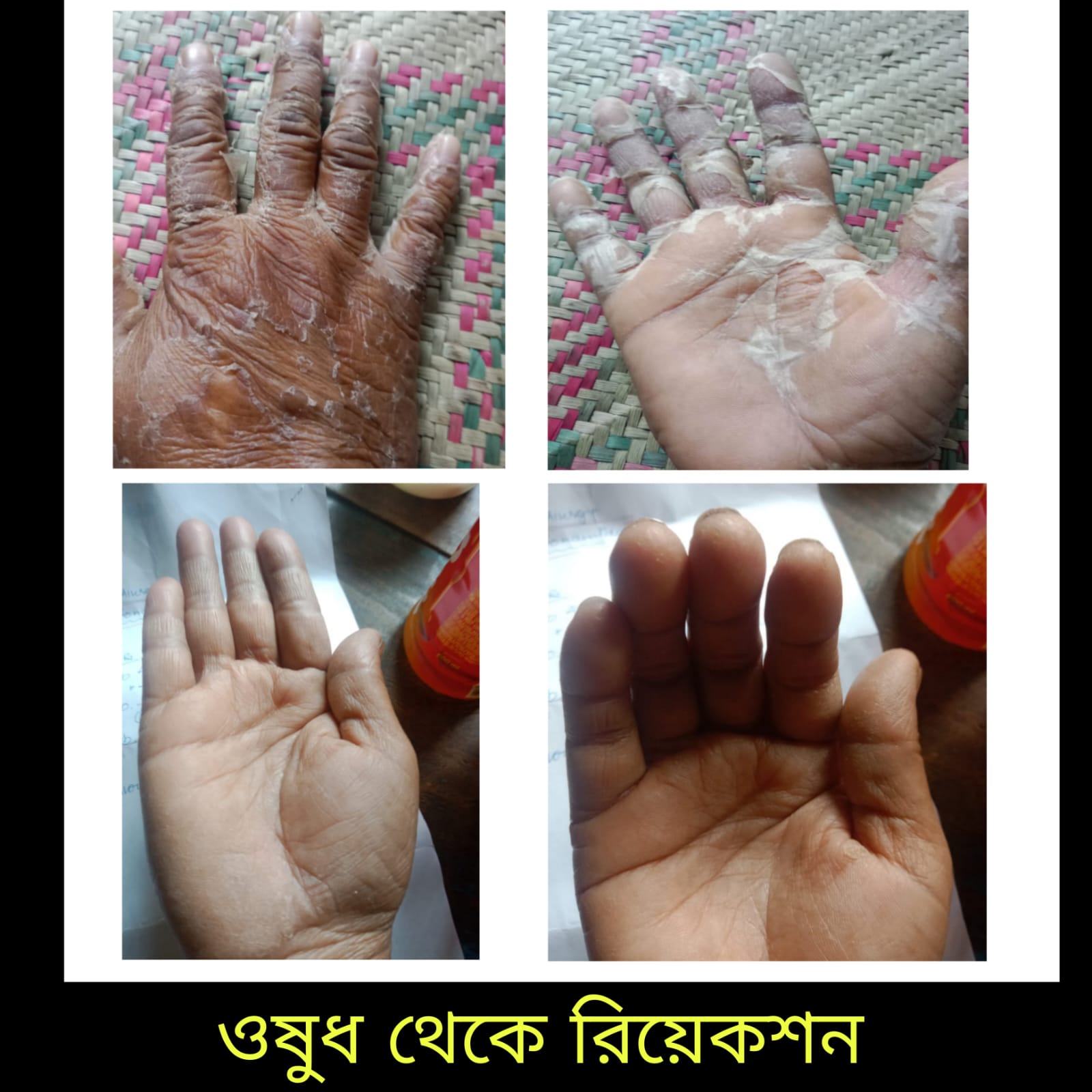 Treatment Image 9